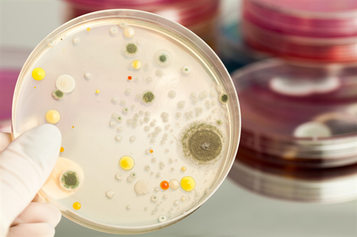 Valutazione Specifica del Rischio Biologico